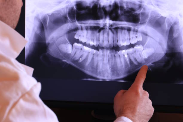 Best Orthodontic Emergency Dentist in Fishersville, VA