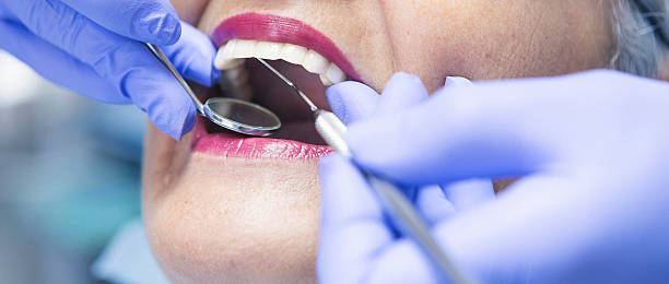 Best Emergency Root Canal Treatment in Fishersville, VA